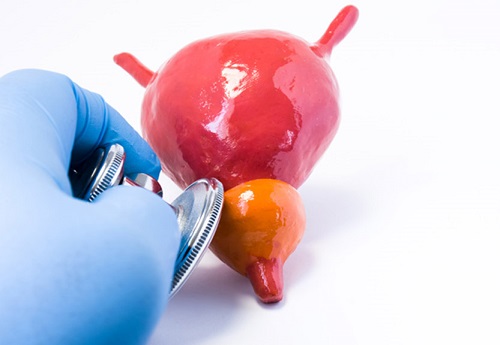 nen-an-gi-va-tranh-an-gi-khi-bi-phi-dai-tien-liet-tuyen